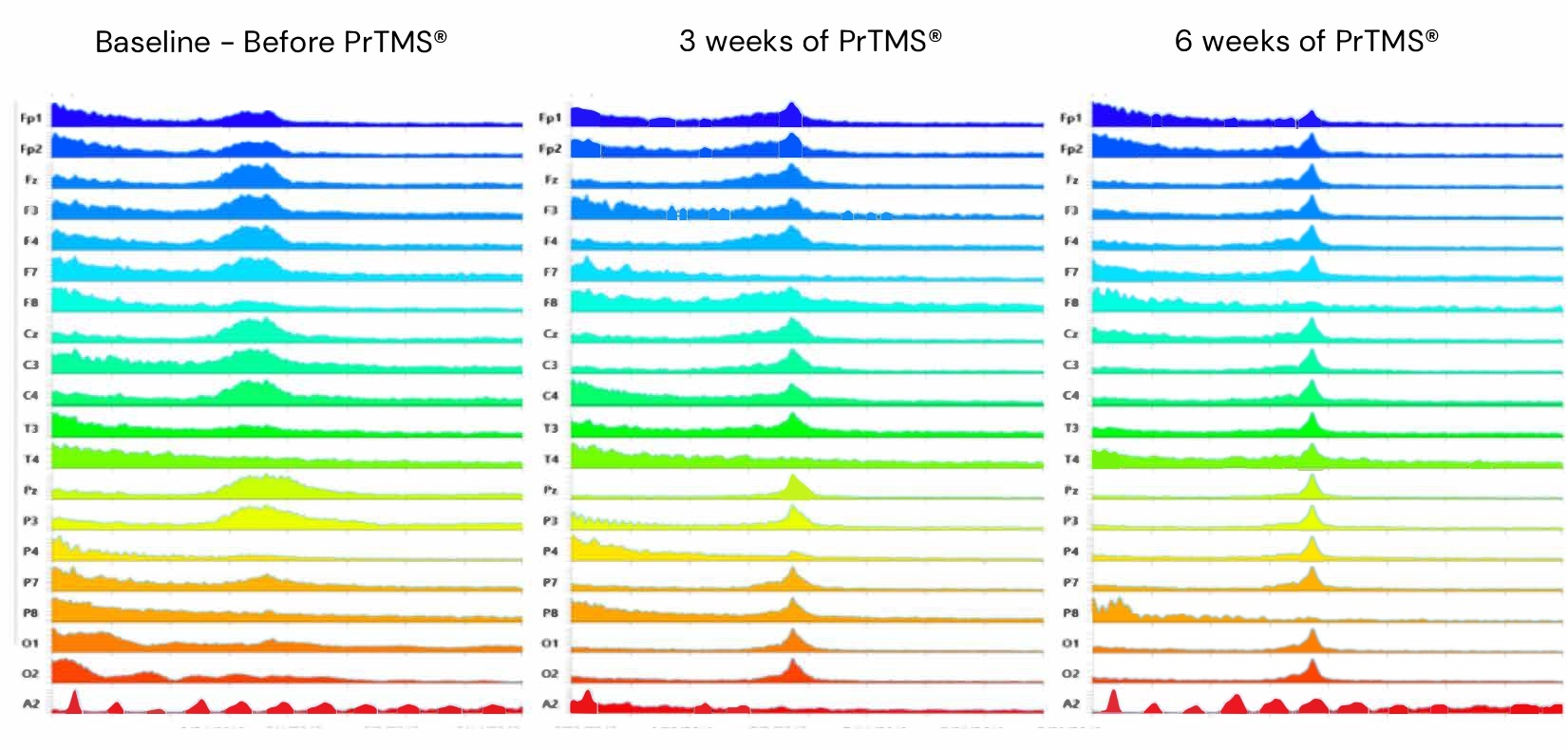 EEG Brain Mapping